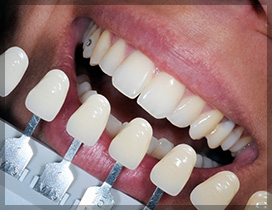 Teeth Whitening