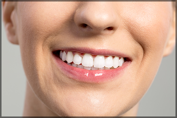 A Perfect Smile