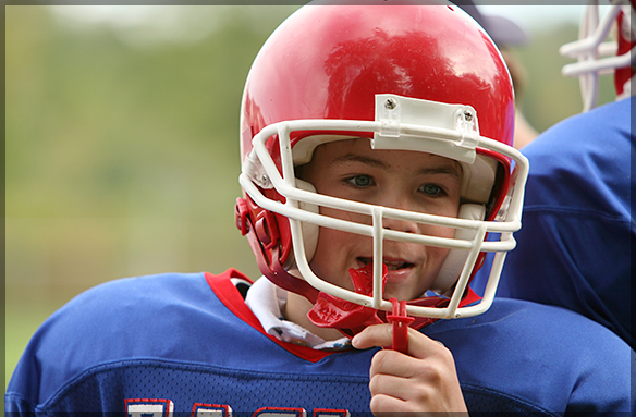 Do You Really Need a Mouth Guard While Playing Sports?