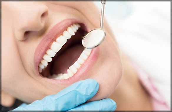 Gum Lift Cosmetic Dentistry Procedure